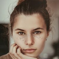 pigmentation
